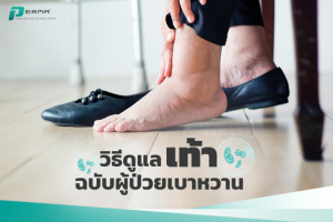 Read more about the article วิธีดูแลเท้าฉบับผู้ป่วยเบาหวาน